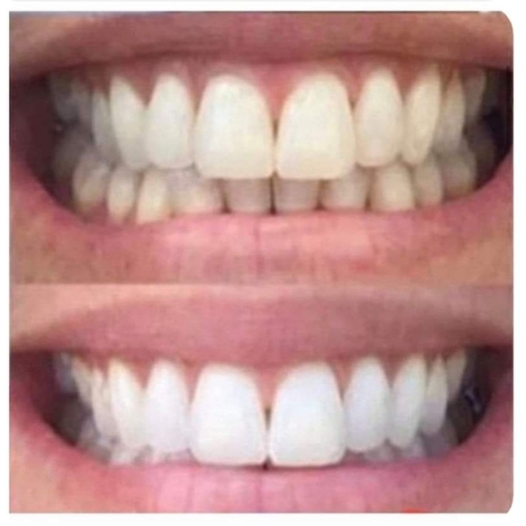 Toothpaste - Picture 2 of 3